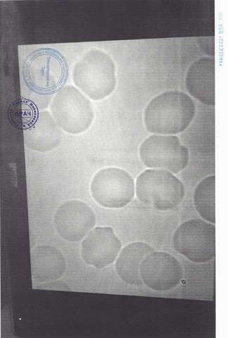 Клетки крови после использования БЖ 2.2